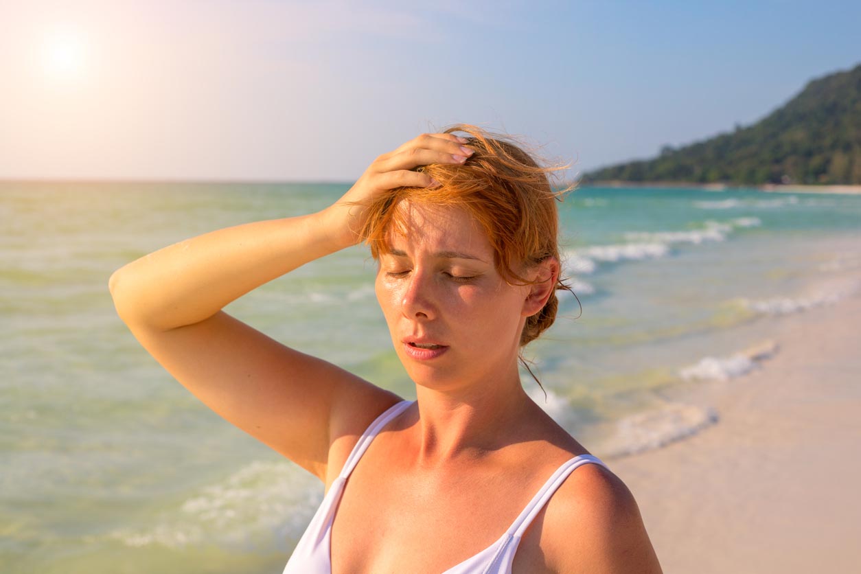 Woman Having Sun Stroke On Sunny Beach. Woman On Hot Beach With Sunstroke.